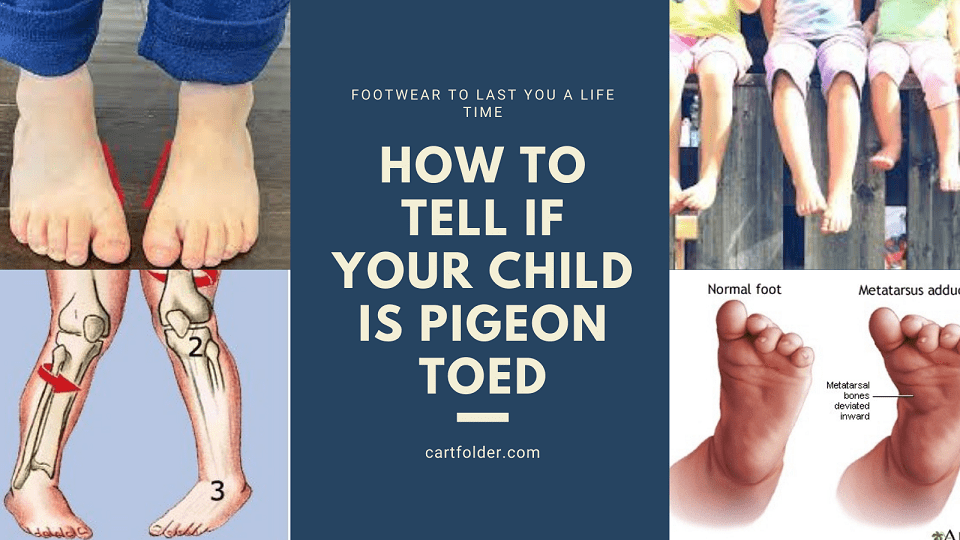 How To Tell If Your Child Is Pigeon Toed