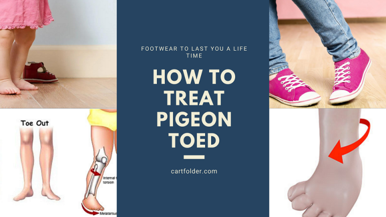 How To Treat Pigeon Toed [February 2022] | CartFolder