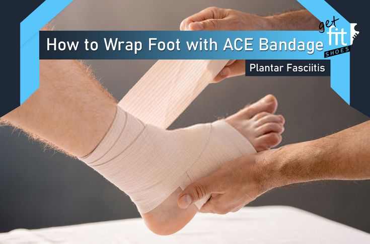 How to Wrap Foot for Plantar Fasciitis With Ace Bandage | [Feb 2022]